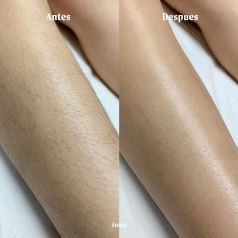 Borrador de Vello Smud™ – Depilación sin dolor en segundos
